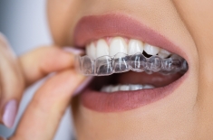 Affordable braces in Houston